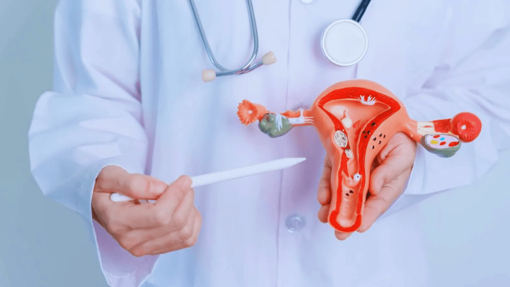 What You Need to Know About PCOS and&nbsp;PCOM